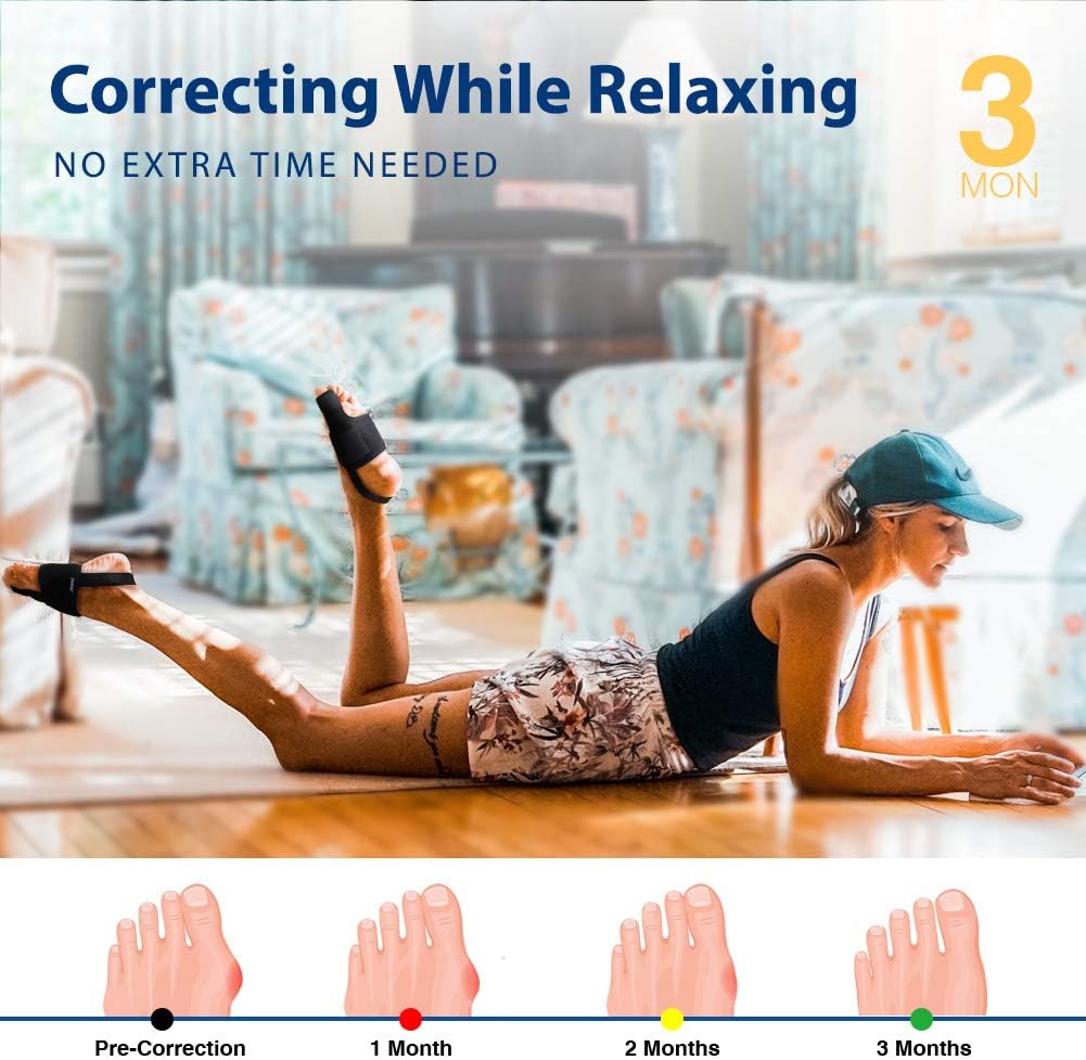 Caretras Bunion Corrector, Orthopedic Bunion Splint, Big Toe Separator Pain Relief, Non-Surgical Hallux Valgus Correction, Hammer Toe Straightener, Day Night Support: Health & Personal Care