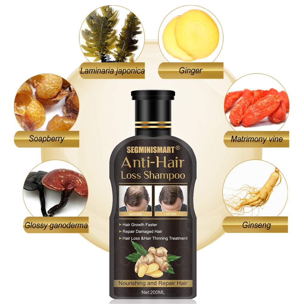 Hair Growth Shampoo,Anti-Hair Loss Shampoo,Hair Loss Shampoo,Hair Thickening Shampoo Helps Stop Hair Loss, Hair Growth for Stronger, Thicker, Longer Hair: Beauty