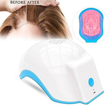 Amazon Com Hair Growth System Anti Hair Loss Device Light