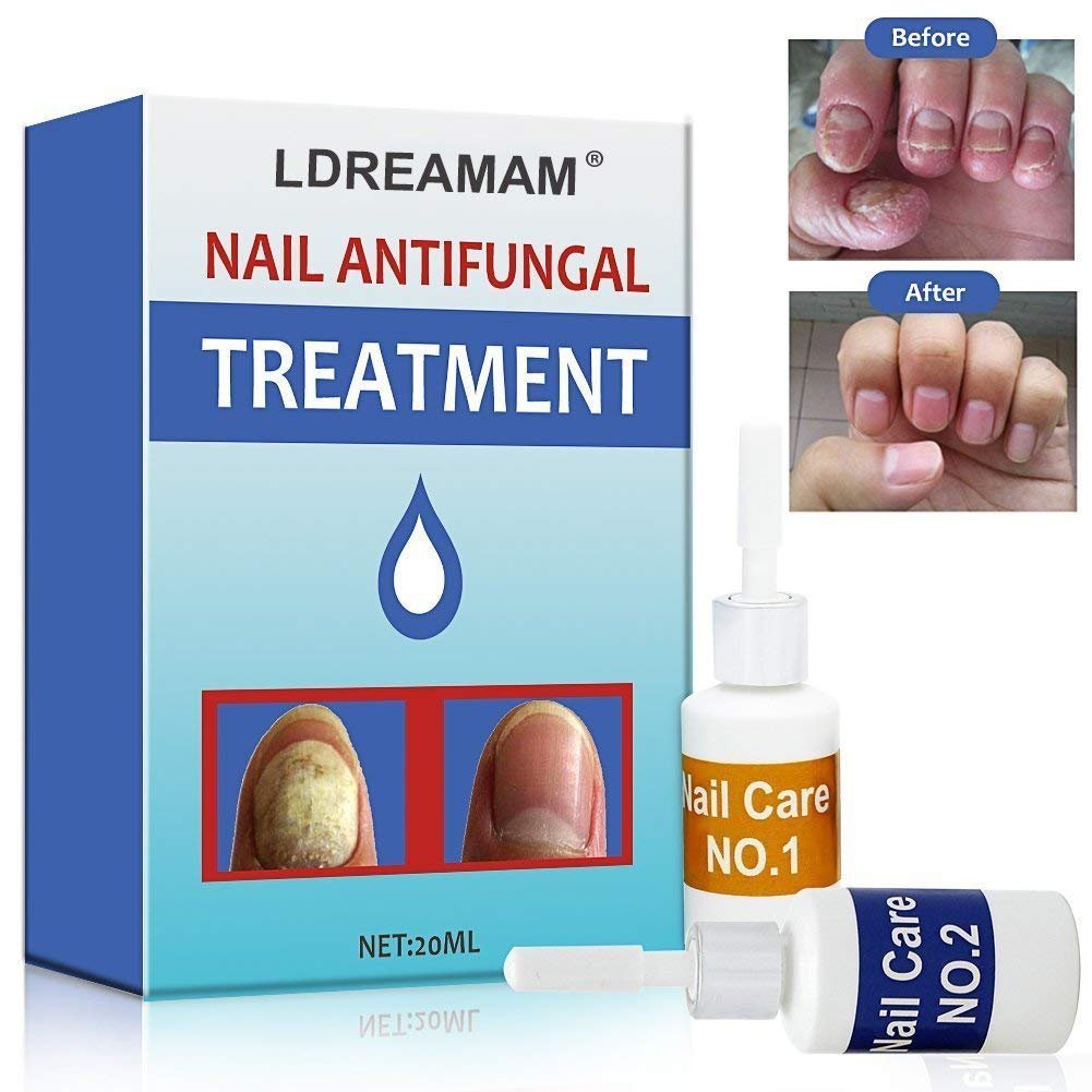 Nail Fungus Treatment, Fungus Stop, Nail Antifungal