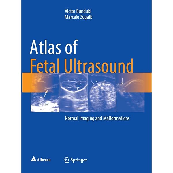 Echocardiographic Anatomy in the Fetus Chiappa， Enrico、 Cook， Andrew C.、 Botta， Gianni; Silverman， Norman H. Echocardiographic Anatomy in the Fetus: 9788847005723: Medicine