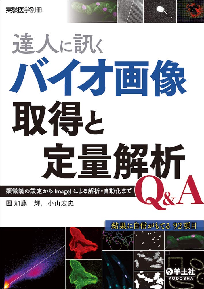 達人に訊くバイオ画像取得と定量解析q A 顕微鏡の設定からimagejによる解析 自動化まで 実験医学別冊 加藤 輝 小山 宏史 本 通販 Amazon