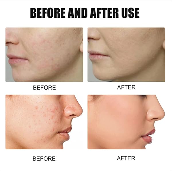 3PC FACE SERUM, ROZINO STOCK SOLUTION FACIAL SERUM, ROZINO 30 DAYS ADVANCED COLLAGEN BOOST ANTI-AGING FACE SERUM, ROZINO ANTI AGING SERUM, COLLAGEN SERUM FOR REPAIR AND GLOW SKIN