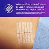 3M Steri-Strip Reinforced Skin Closures 6mm x 100mm Pack of 10 view 5