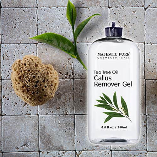 Callus Remover for Feet by Majestic Pure - Gel with Tea Tree Oil for Corn and Callus - Moisturizes & Hydrates Toughened & Dry Skin, Removes Dead Skin, 8.8 fl. oz.