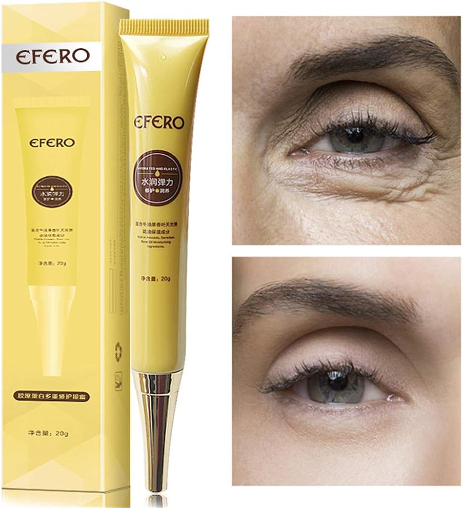 retinol cream for puffy eyes