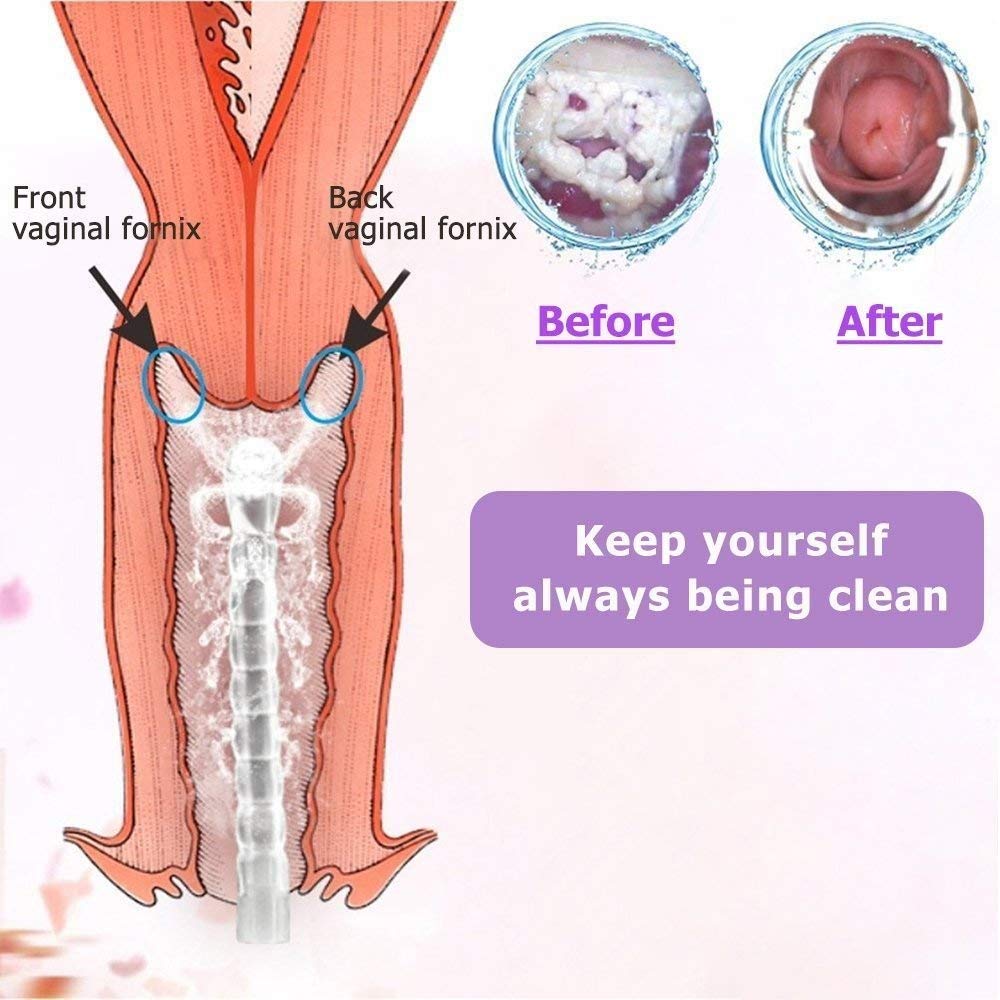 Reusable Vaginal Cleansing System Excellent Vaginal Cleanser Female Vaginal Rinse, Manual Pressure Clean, 100% Safe, 300 ml Capacity Extra 2 Nozzle Tips Doctor Recommended (300ml)