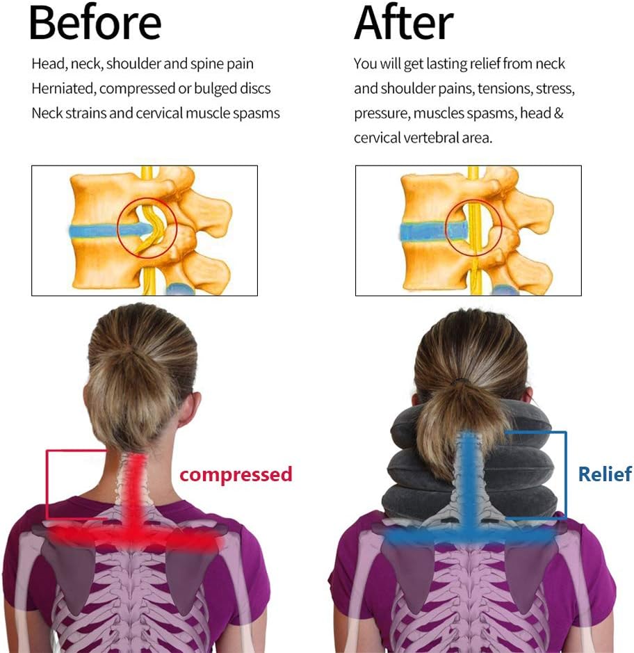Cervical Neck Traction - Effective Neck Pain Remedy at Home - Inflatable & Adjustable Neck Stretcher Collar Device - Ideal for Spine Alignment & Chronic Neck & Shoulder Pain Relief (Blue): Health & Personal Care