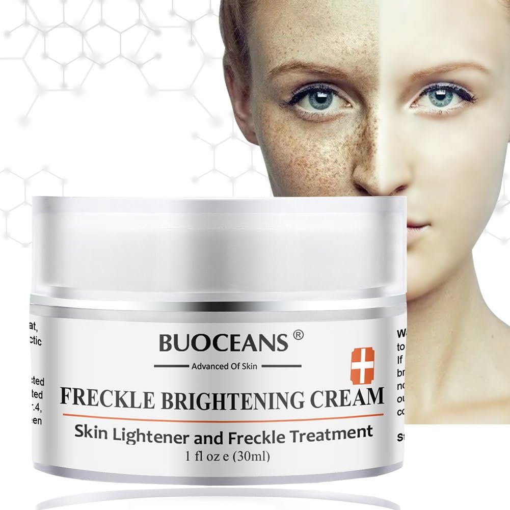 best moisturizer for freckles