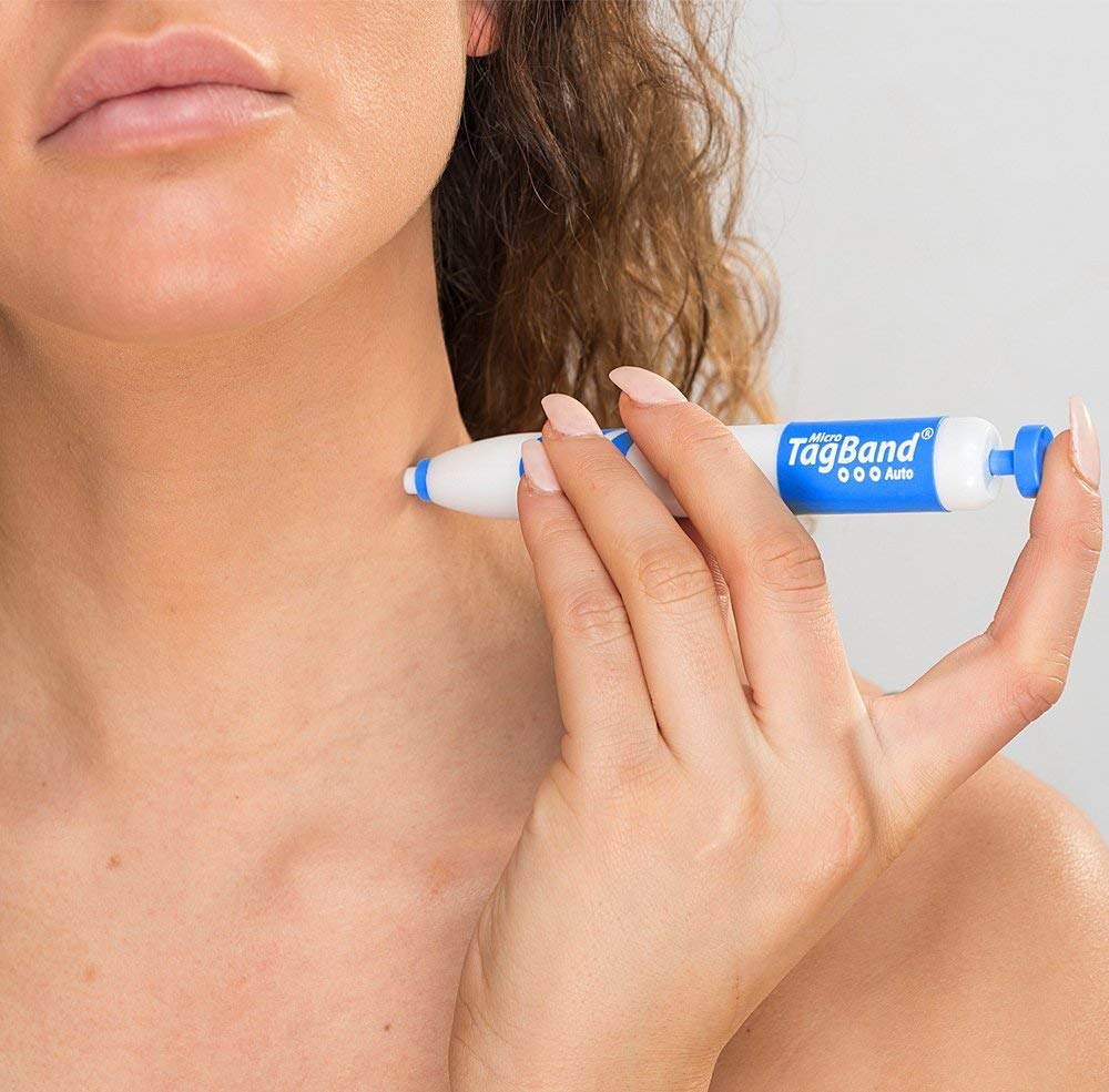 Micro Auto TagBand Skin Tag Remover Device for Small to Medium Skin Tags : Beauty