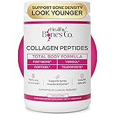 FORTIBONE® Premium Bone Health Collagen Peptides w/FORTIGEL®, VERISOL® & TENDOFORTE®, Clinically-Supported for Bones, Joints Skin Hair Nails, Hydrolyzed Collagen, Anti-Aging Formula (30 Servings)