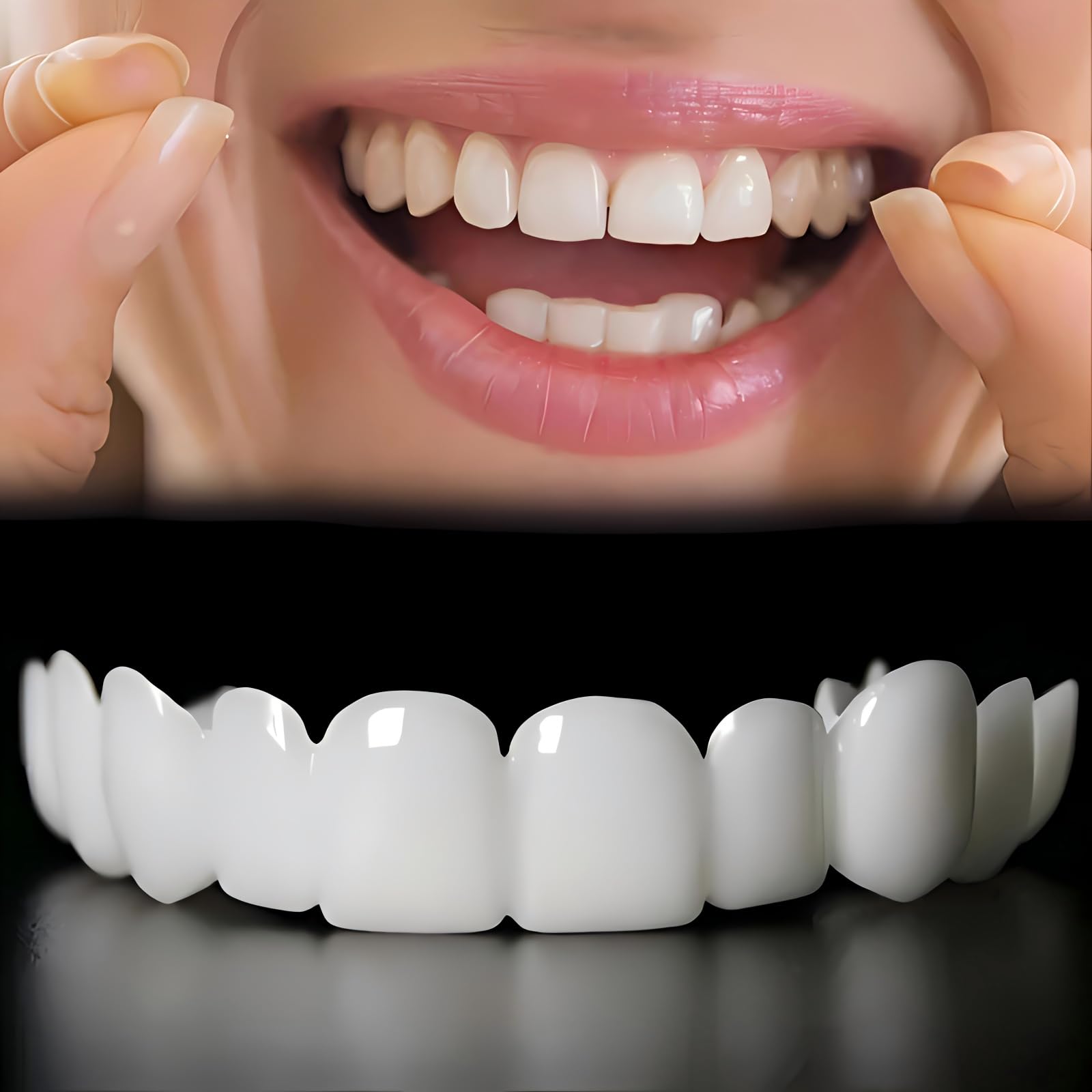 Photo 1 of 2 Pairs Adjustable Smile Support Can Quickly Restore Confident Smile (Upper and Lower Braces)