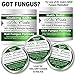 Dr. Cole’s Organic Herbal Skin Fungus Soaking Salts – May Assist with Skin Fungus Infections, Jock Itch, Athlete’s Foot, etc
