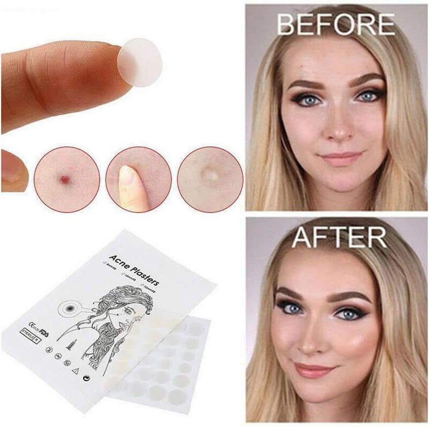36 Acne Pimple Spot Zit Patches Face Treatment Stickers Pimple Cover Invisible Hydrocolloid Absorbing Cover Up Covering Healing Patch for Concealer Blemish Care + Free Blackhead Zit Remover Tool - Image 4