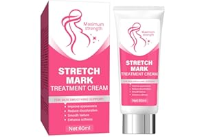 ATAZUA Stretch Mark Cream for Pregnancy, Advanced Stretch Marks Removal, Helps Prevent and Treat Stretch Marks, Smooth and Firm the Skin, 2.1 Oz