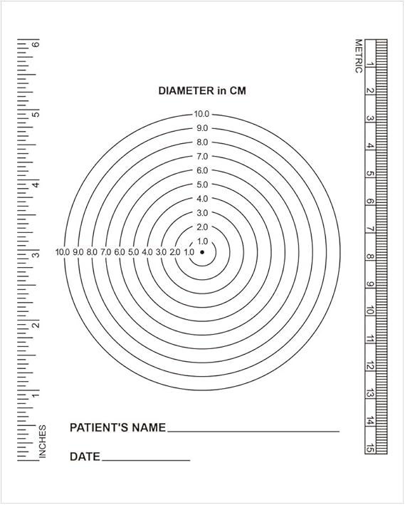 Amazon.com: Edtape (Pack of 100) Wound Measurement Tools Wound ...