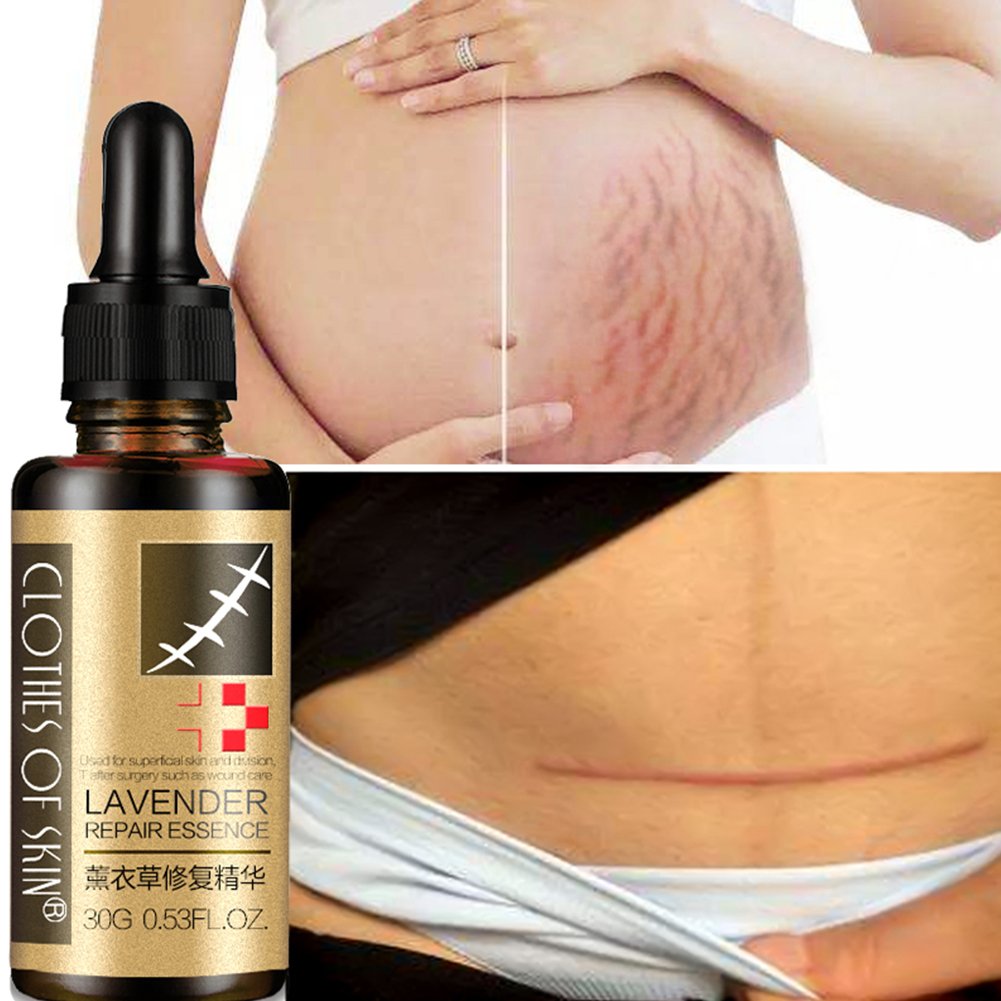 Amazon Com Onkessy Scar Removal Oil Scar Repair Oil Scar Stretch Marks Removal Treatment Lavender Repair Essence Scar Cream Skin Care Oil Body Oil Skin Repair Cream Hydrate Brighten Skin