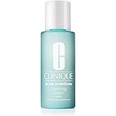 Clinique Acne Solutions Clarifying Lotion Exfoliating Facial Toner with Salicylic Acid | Reduces Oil + Unclogs Pores