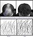 Original Samson Hair Building Fibers DARK BROWN 50gr Refill suitable for all brands
