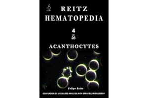 Acanthocytes: Compendium of Live Blood Analysis with Darkfield Microscopy