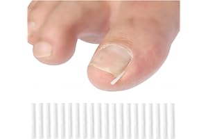 Ingrown Toenail Kit, 20Pcs White Ingrown Toenail Correction Strips Brace Kit, Strips Recover Clips Toenails Thick Pedicure To