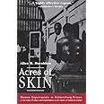 Acres of Skin: Human Experiments at Holmesburg Prison