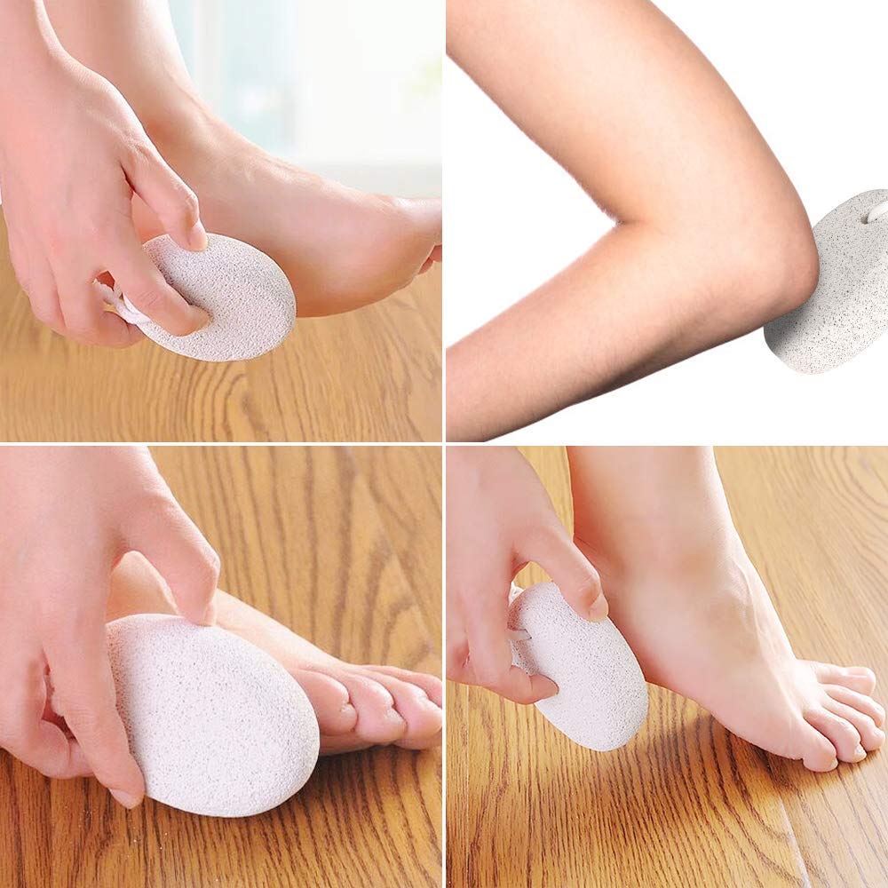 ZECLIN Natural Pumice Stone for Foot Callus - Premium Callus Remover for Feet and Hands - Pedicure Tools, Exfoliation to Remove Dead Skin - Natural Foot File (2 Pcs): Beauty