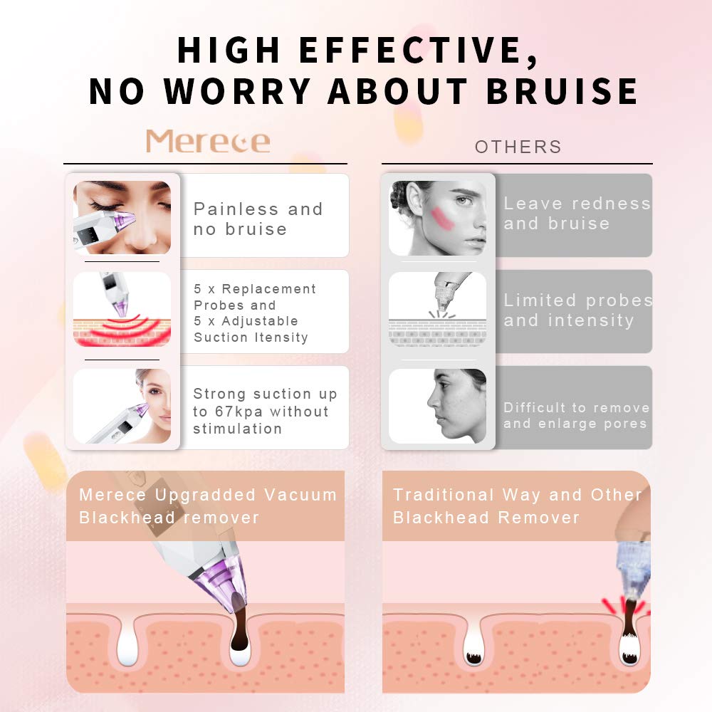 Blackhead Remover Vacuum Pore Cleaner - Merece Upgrade Blackhead Removal Tool Electric Black Head Face Vacuum Comedone Extractor Acne Sucker Whitehead Treatment with USB Rechargeable 3 Skin Care Light: Beauty