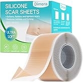 Dimora Medical Grade Silicone Scar Sheets - Ultra Soft Silicone Scar Tape (1.6”x120" Roll), Waterproof Scar Treatment for Surgical Scars, C Section, Tummy Tuck, Keloid Treatment