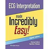 ECG Interpretation Made Incredibly Easy! (Incredibly Easy! Series®)
