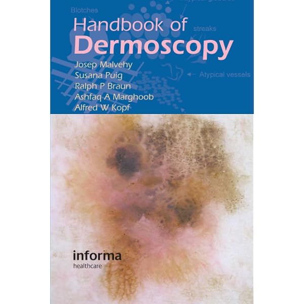 カラーアトラスdermoscopy Amazon | An Atlas of Surface Microscopy