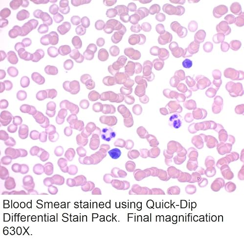 Rapi Diff Stain Quick-Dip Differential Stain Pack For Hematology Quick-Dip Differential ...