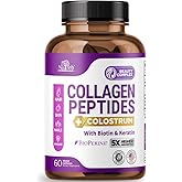 Nutreb Collagen Peptides for Women with Colostrum, Biotin and Keratin - Type I, II, III, V, X - 5X Higher Absorption - Hair Skin and Nails Vitamins - Collagen for Women - Collagen Pills - 60 Capsules