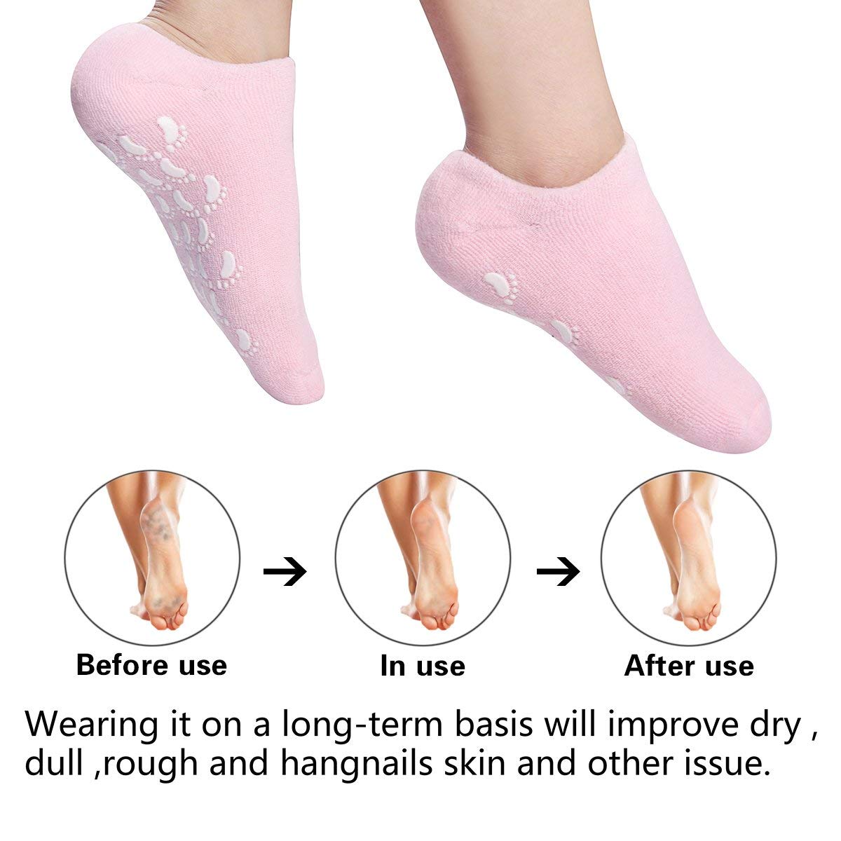 Moisturizing Gel Socks, Ultra-Soft Original Gel Socks Moisturizing Socks, Spa Gel Soften Socks for Dry Cracked Feet Skins, Gel Lining Infused with Essential Oils and Vitamins (2 Pair Blue&Pink) : Beauty