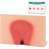 MedEduQuest Decubitus Ulcer Wound Care Model, Bedsores Model | Pressure Injury Model for Medical Training Practice, Stage 1