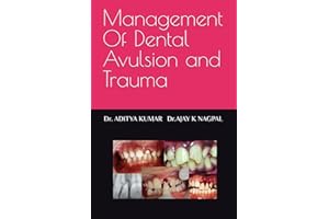 Management Of Dental Avulsion and Trauma