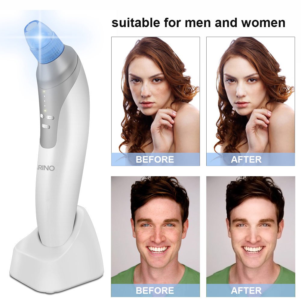 ARINO Aspirazione Viso Pulitore Punti Neri Comedone Facial Pore Cleaner Pulizia Viso Elettrico Estrattore Acne con 4 Testine Detergenti Intercambiabili per Esfoliazione Cura della Pelle Naso Donne Uomini Antirughe USB Ricaricabile Bianco