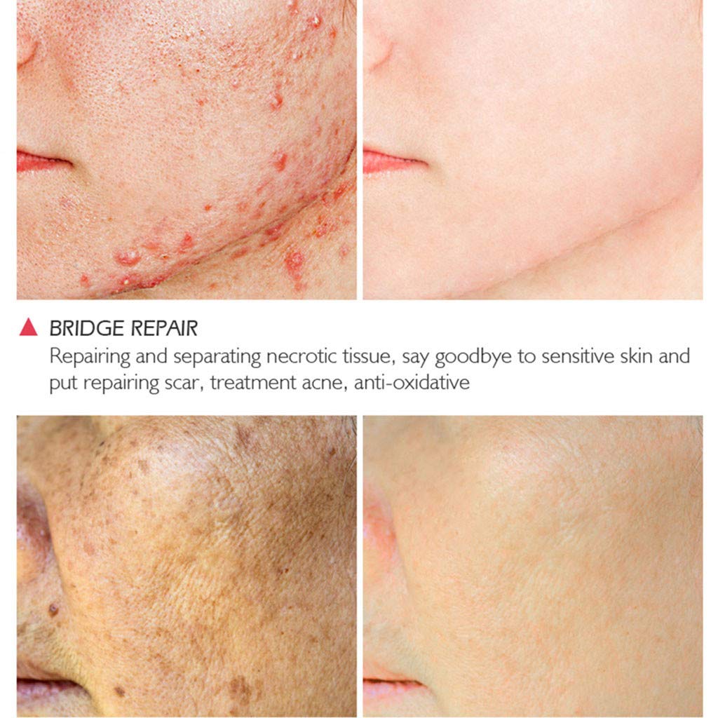 crocodile scar cream