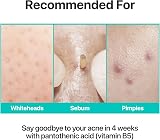 numbuzin No.1 Cream Pantothenic B5 Oil Control Acne Soothing Moisturizer 80ml view 4