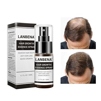 Allbesta Hair Growth Agent Spray Supports And Promotes The Growth
