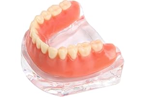 KOUYOT Dental Model Overdenture Transparent Dental Implants Model Detachable Model Lower Jaw Dental Teaching Model Suitable for Education and Study Silver