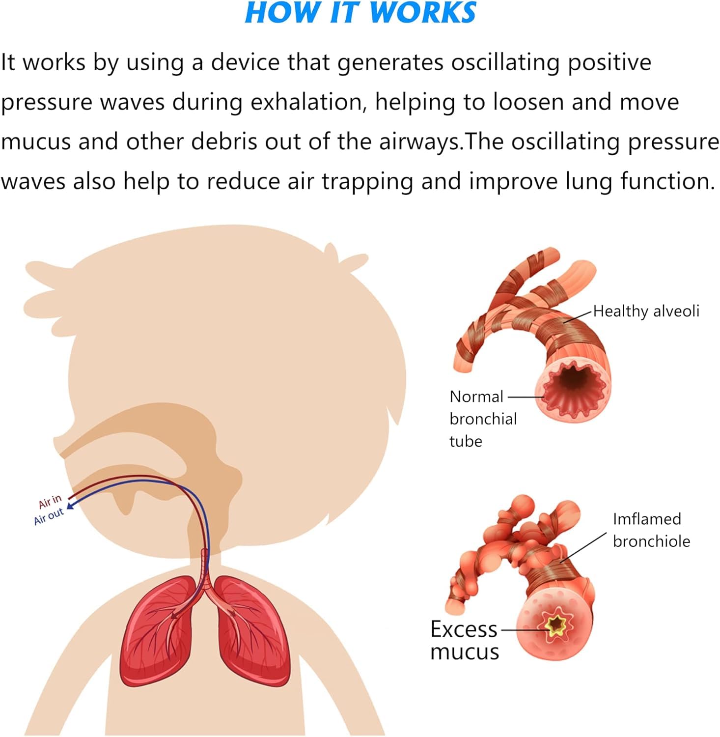 MILLSTEPS Breathing Exercise Device for Lungs,Mucus Relief and Lung Expansion Device - Clear Mucus from Airways Naturally & Build Stronger Lungs (Blue)