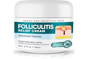 Weeping Willow Oil Co - Folliculitis Treatment, Safe, Fast & Effective Folliculitis Cream for Face, Scalp, Folliculitis and Dandruff, Lichen - 60g