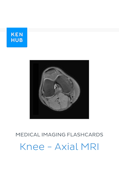 Medical Imaging Flashcards Knee Axial Mri Learn All Bones Ligaments Muscles Mri Arteries Nerves And Veins On The Go Kenhub Flashcards Book 54 Kindle Edition By Kenhub Kenhub Professional Technical Kindle Ebooks Amazon Com