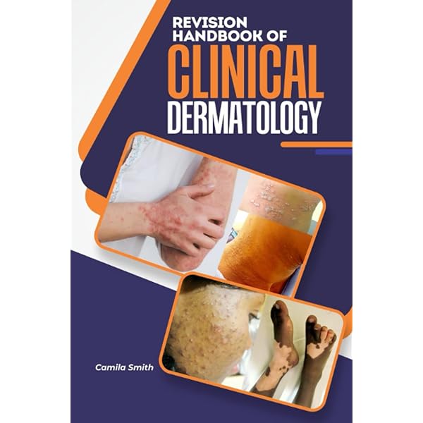 Lookingbill and Marks' Principles of Dermatology (PRINCIPLES OF