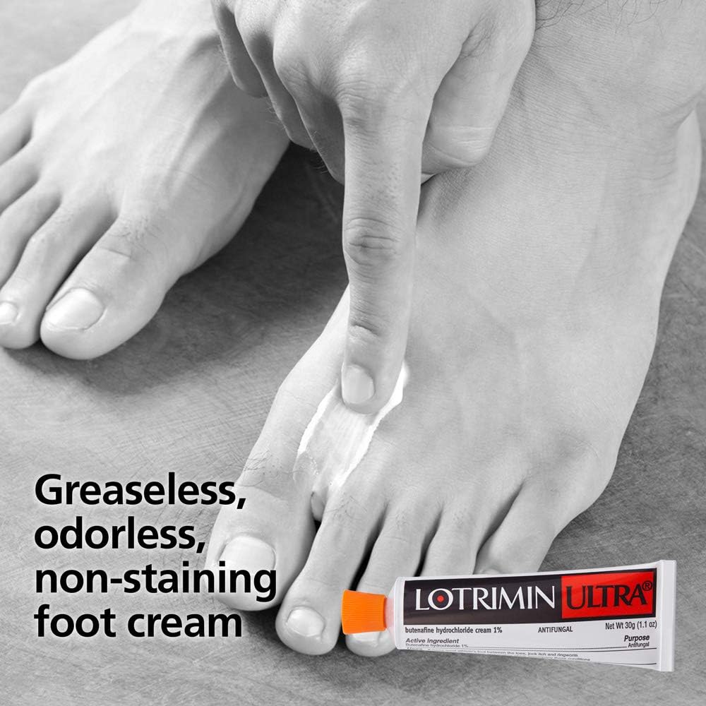 Lotrimin Ultra 1 Week Athlete's Foot Treatment, Prescription Strength Butenafine Hydrochloride 1%, Cures Most Athlete?s Foot Between Toes, Cream, 1.1 Ounce: Health & Personal Care