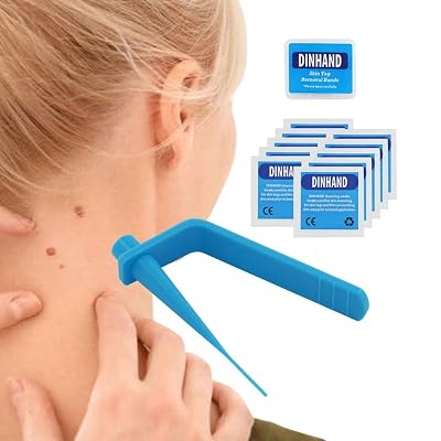 Premium Skin Tag Remover Device - Skin Tag Removal Kit Remove Medium to Large Skin Tags