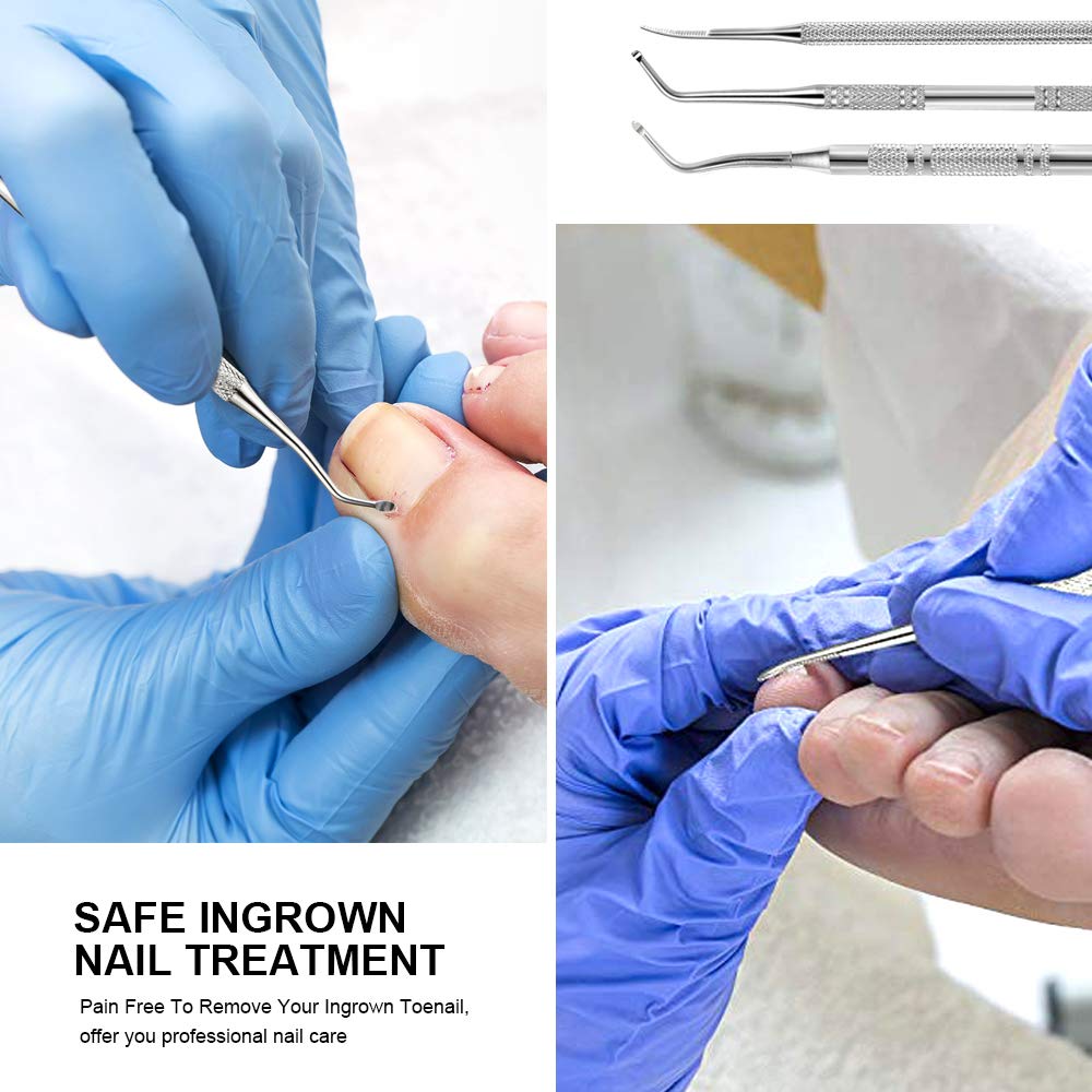 3pcs Ingrown Toenail File And Lifters, [ Upgraded ] Teenitor Professional Surgical Safe Nail Treatment Pedicure Tool Kit Under Nail Cleaner Tools Pain Relief: Beauty