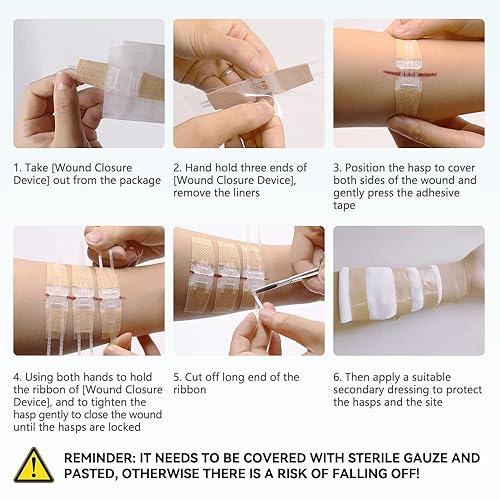 Wound Closure Strips | Secure & Effective Wound Healing
