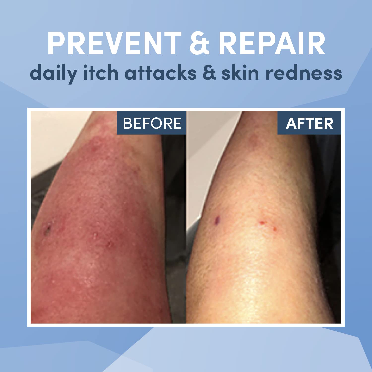 Wrap-E-Soothe Eczema Clothing for Kids - Arm and Leg Sleeves for Girls and Boys - Itch Relief, Ultra-Soft, and Eco-Friendly (Small 5-7 in)